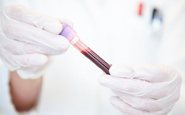 Analyse im deutschen Labor